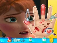 Anna frozen hand doctor: fun games for girls onlin